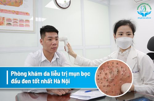 Hướng dẫn cách trị mụn trứng cá tuổi dậy thì
